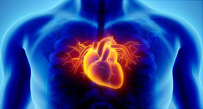 Heart Problems