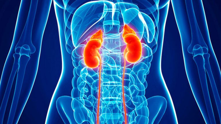 Kidney Problems